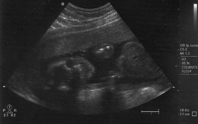 scan0001-copy
